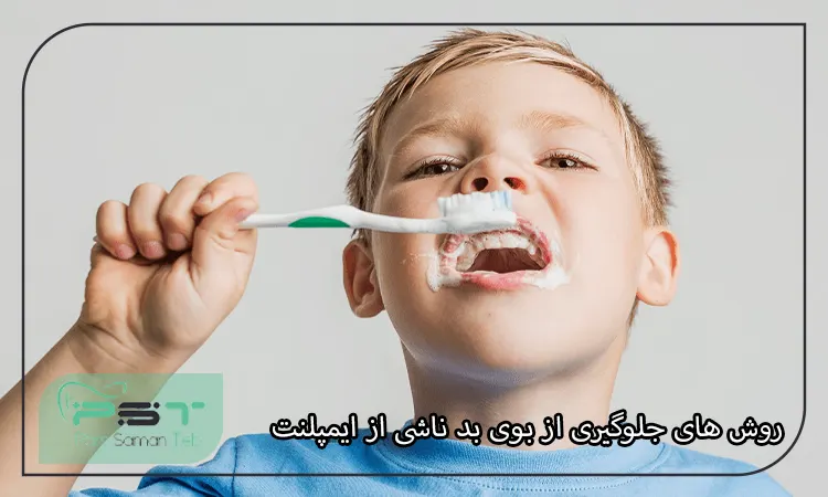 روش‌ های جلوگیری از بوی بد ناشی از ایمپلنت