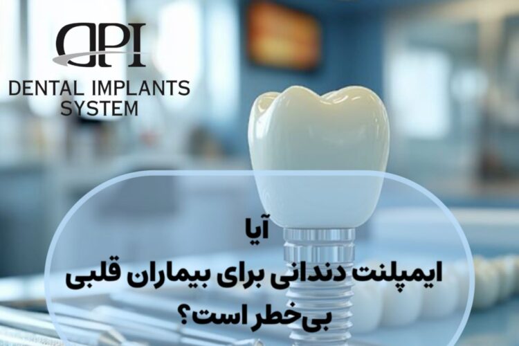 ایمپلنت دندانی برای بیماران قلبی