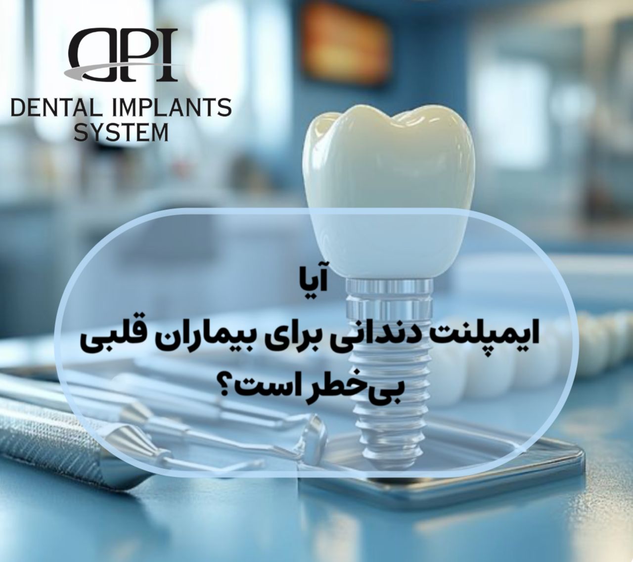 ایمپلنت دندانی برای بیماران قلبی